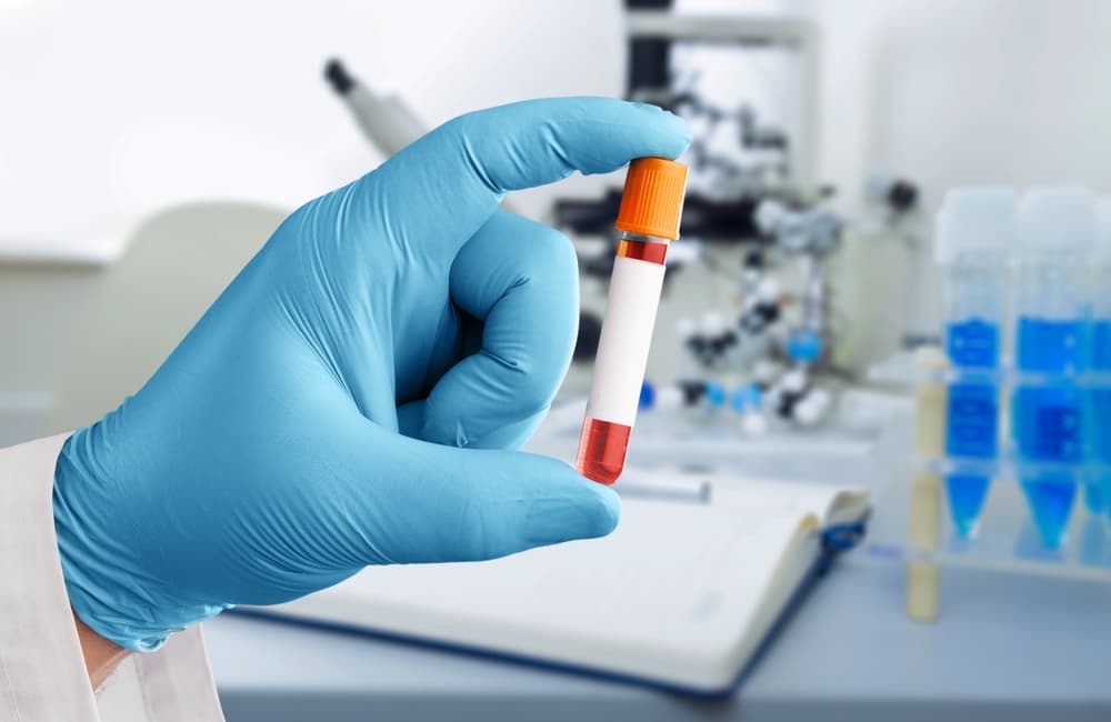 Fertility Blood Tests in Northern Virginia: Results Explained cover image