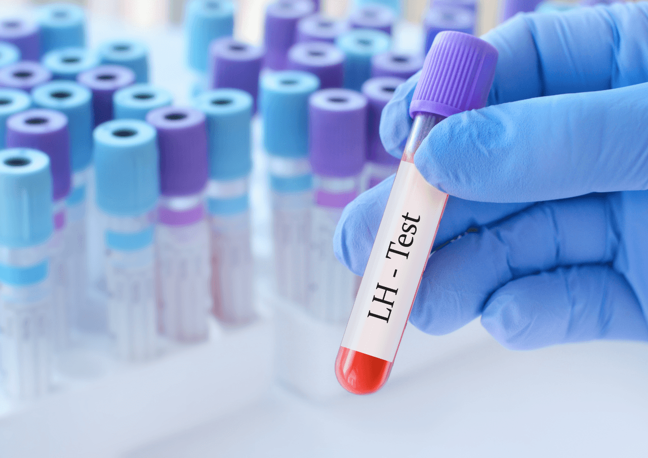 A Comprehensive Guide to Fertility Hormone Tests in Fairfax County cover image