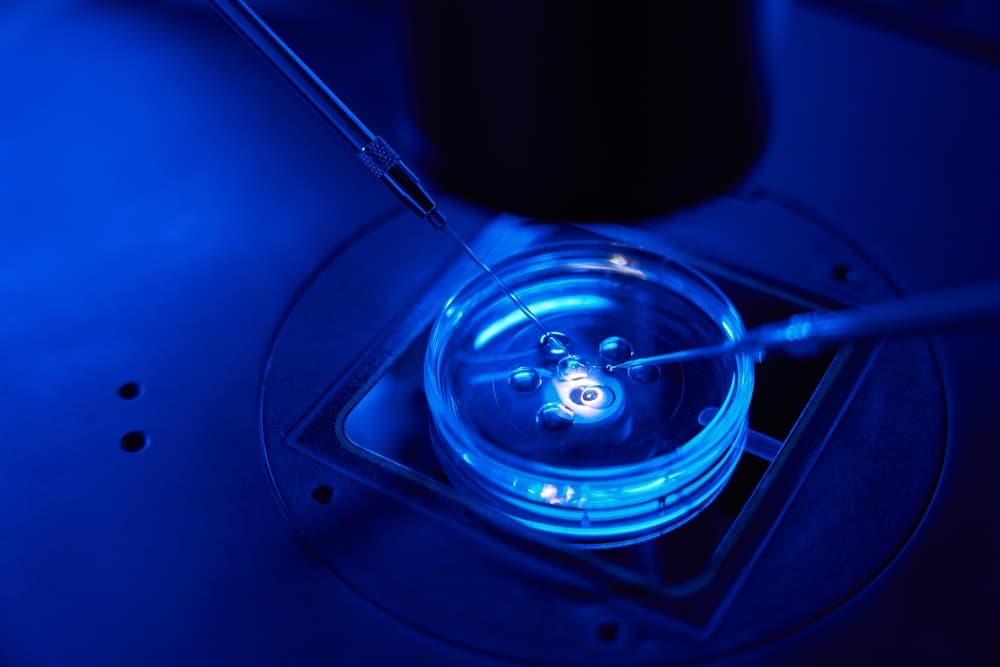 Intracytoplasmic Sperm Injection: A Complete Guide to ICSI in Fairfax, Virginia cover image