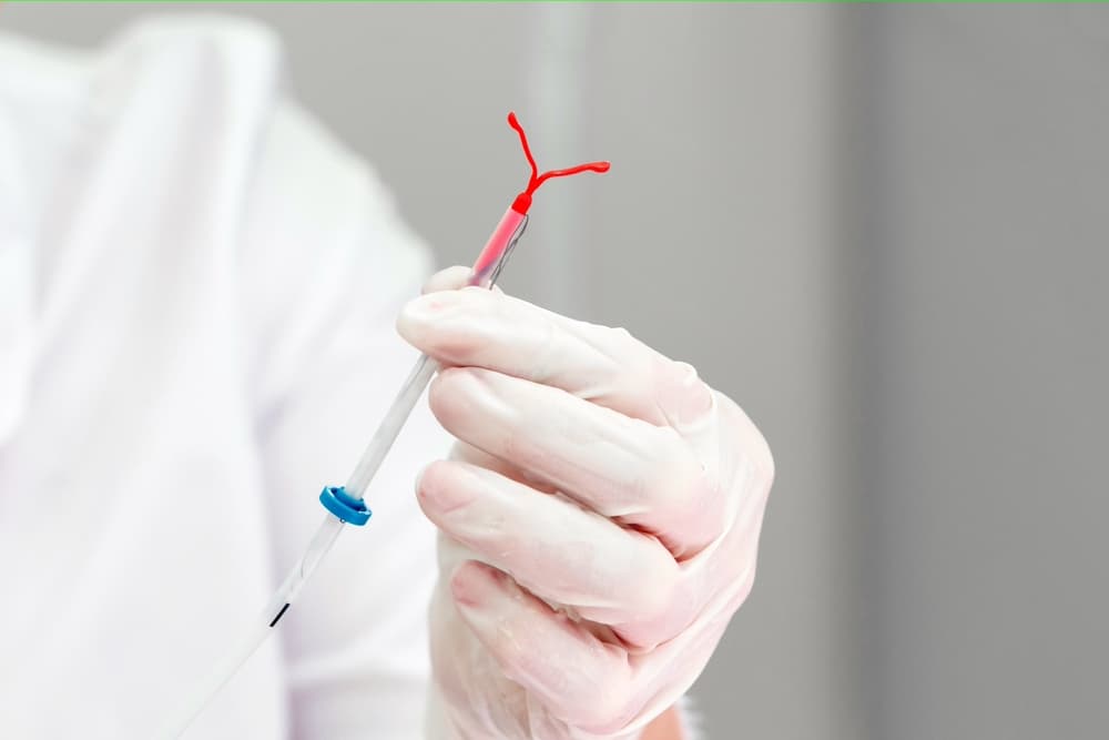 IUD Consultation and Birth Control Appointment in Dumfries VA